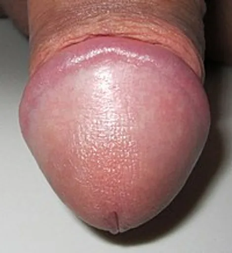 Archived external image
