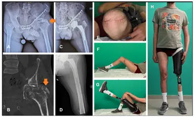 SPOILER_medicina-60-01551-g002.png